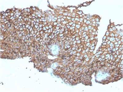 Immunohistochemistry-Paraffin: Desmoglein-3 Antibody (DSG3/2840) - Azide and BSA Free [NBP3-08509]