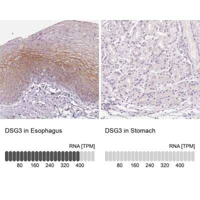 Immunohistochemistry-Paraffin: Desmoglein-3 Antibody [NBP2-54729]