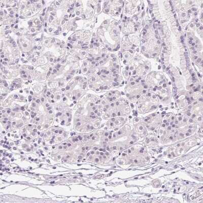 Immunohistochemistry-Paraffin: Desmoglein-3 Antibody [NBP2-54744]