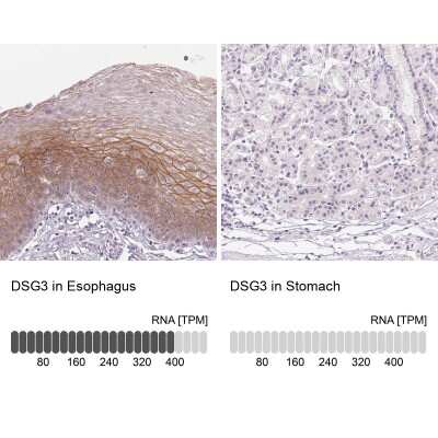 Immunohistochemistry-Paraffin: Desmoglein-3 Antibody [NBP2-54744]