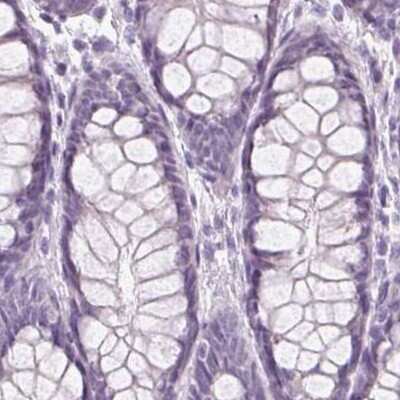 Immunohistochemistry-Paraffin: Desmoglein-3 Antibody [NBP2-54744]