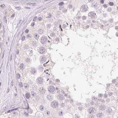 Immunohistochemistry-Paraffin: Desmoglein-3 Antibody [NBP2-54744]