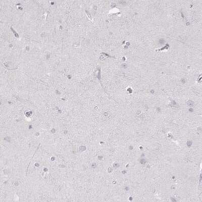 Immunohistochemistry-Paraffin: Desmoglein-4 Antibody [NBP2-31770]