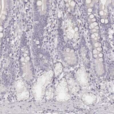 Immunohistochemistry-Paraffin: Desmoglein-4 Antibody [NBP2-31770]