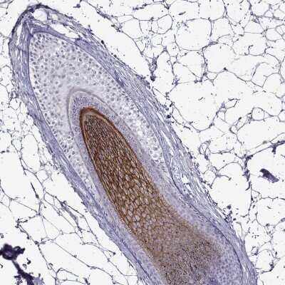 Immunohistochemistry-Paraffin: Desmoglein-4 Antibody [NBP2-31770]