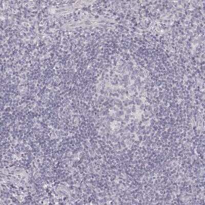 Immunohistochemistry-Paraffin: Desmoglein-4 Antibody [NBP2-31770]