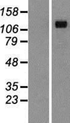 Western Blot: Desmoglein-4 Overexpression Lysate [NBP2-05007]