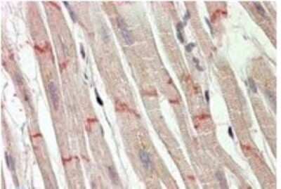 Immunohistochemistry-Paraffin: Desmoplakin Antibody [NBP1-49879]