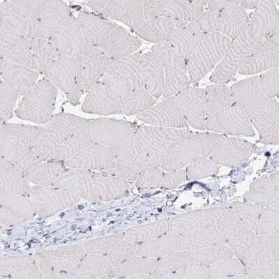 Immunohistochemistry-Paraffin: Desmoplakin Antibody [NBP2-48836]