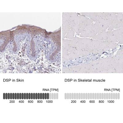 Immunohistochemistry-Paraffin: Desmoplakin Antibody [NBP2-48836]