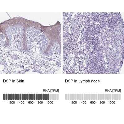 Immunohistochemistry-Paraffin: Desmoplakin Antibody [NBP2-49158]