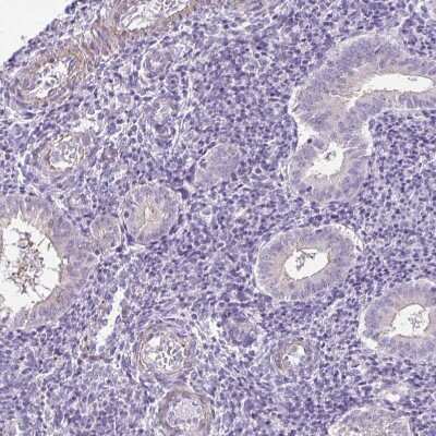 Immunohistochemistry-Paraffin: Desmoplakin Antibody [NBP2-49158]