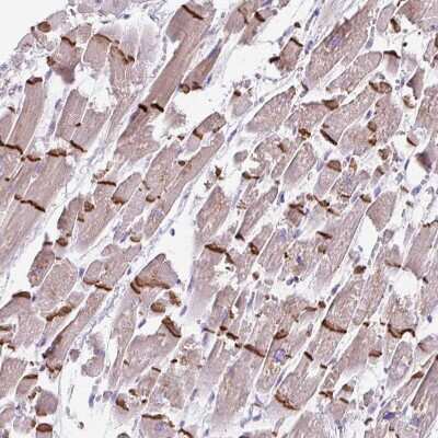 Immunohistochemistry-Paraffin: Desmoplakin Antibody [NBP2-49158]