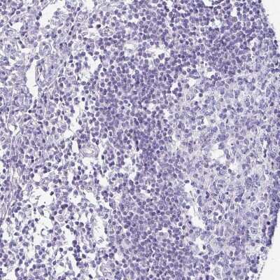 Immunohistochemistry-Paraffin: Desmoplakin Antibody [NBP2-49158]