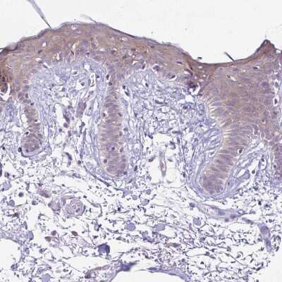 Immunohistochemistry-Paraffin: Desmoplakin Antibody [NBP2-49158]