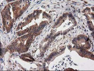 Immunohistochemistry-Paraffin: Destrin Antibody (OTI2F7) [NBP2-00527]