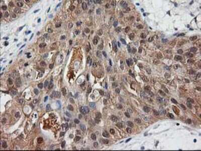 Immunohistochemistry-Paraffin: Destrin Antibody (OTI2F7) [NBP2-00527]