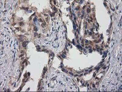 Immunohistochemistry-Paraffin: Destrin Antibody (OTI2F7) [NBP2-00527]
