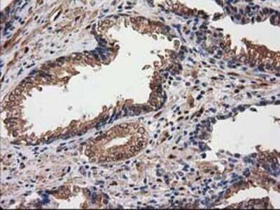 Immunohistochemistry-Paraffin: Destrin Antibody (OTI2F7) [NBP2-00527]