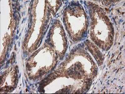 Immunohistochemistry-Paraffin: Destrin Antibody (OTI2F7) [NBP2-00527]