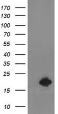 Western Blot: Destrin Antibody (OTI2F7) [NBP2-00527]