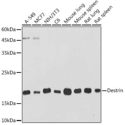 Western Blot: Destrin Antibody (4F9Q1) [NBP3-15907]