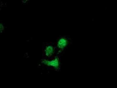 Immunocytochemistry/ Immunofluorescence: Destrin Antibody (OTI2F7) - Azide and BSA Free [NBP2-71669]