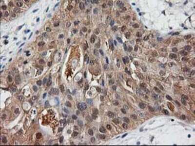 Immunohistochemistry: Destrin Antibody (OTI2F7) - Azide and BSA Free [NBP2-71669]