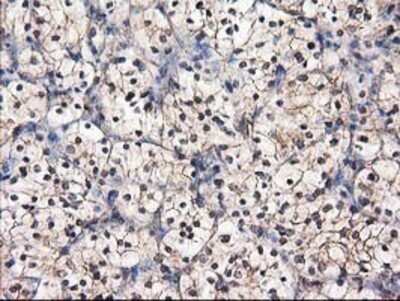 Immunohistochemistry: Destrin Antibody (OTI2F7) - Azide and BSA Free [NBP2-71669]