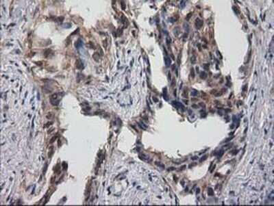 Immunohistochemistry: Destrin Antibody (OTI2F7) - Azide and BSA Free [NBP2-71669]