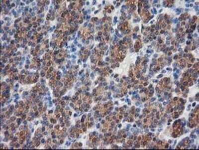 Immunohistochemistry: Destrin Antibody (OTI2F7) - Azide and BSA Free [NBP2-71669]