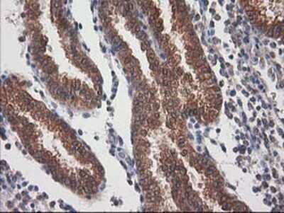 Immunohistochemistry: Destrin Antibody (OTI2F7) - Azide and BSA Free [NBP2-71669]