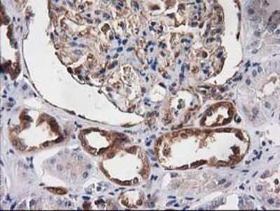 Immunohistochemistry: Destrin Antibody (OTI2F7) - Azide and BSA Free [NBP2-71669]