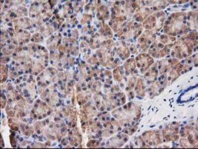 Immunohistochemistry: Destrin Antibody (OTI2F7) - Azide and BSA Free [NBP2-71669]