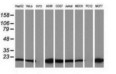 Western Blot: Destrin Antibody (OTI2F7)Azide and BSA Free [NBP2-71669]