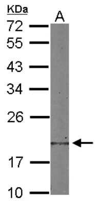 Western Blot: Destrin Antibody [NBP2-16154]