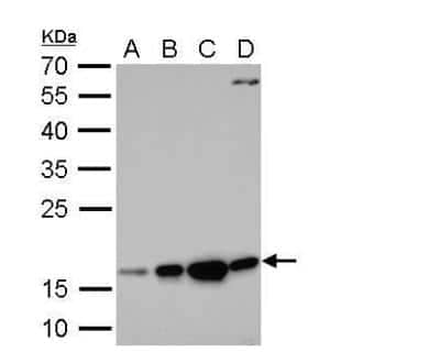 Western Blot: Destrin Antibody [NBP2-16154]
