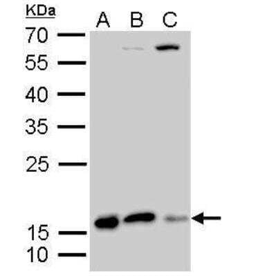 Western Blot: Destrin Antibody [NBP2-16154]