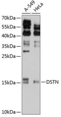 Western Blot: Destrin AntibodyBSA Free [NBP2-92042]