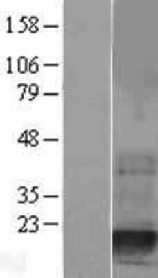 Western Blot: Destrin Overexpression Lysate [NBL1-10028]