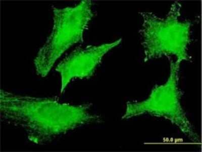 Immunocytochemistry/ Immunofluorescence: Dexras1 Antibody (2D12) [H00051655-M01]