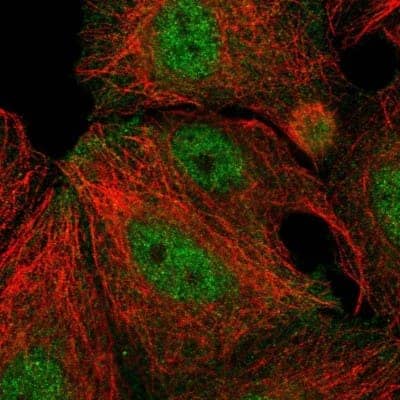 Immunocytochemistry/ Immunofluorescence: Dexras1 Antibody [NBP1-91830]