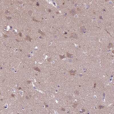 Immunohistochemistry-Paraffin: Dexras1 Antibody [NBP1-91830]