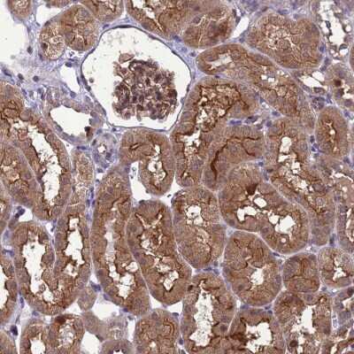 Immunohistochemistry-Paraffin: Dexras1 Antibody [NBP1-91830]