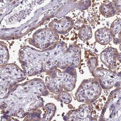 Immunohistochemistry-Paraffin: Dexras1 Antibody [NBP1-91830]