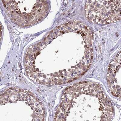Immunohistochemistry-Paraffin: Dexras1 Antibody [NBP1-91830]