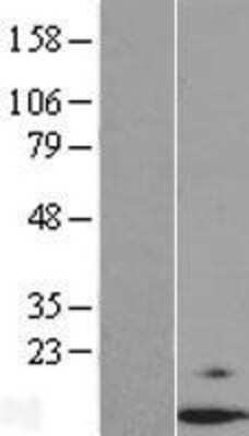 Western Blot: Dexras1 Overexpression Lysate [NBP2-07092]