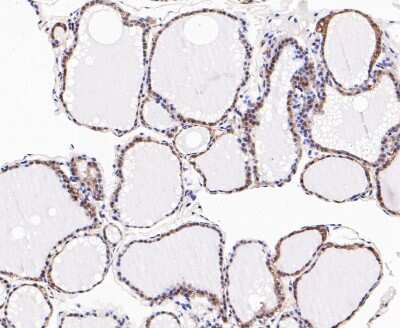 Immunohistochemistry-Paraffin: Dfna5 Antibody [NBP2-80426]
