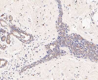 Immunohistochemistry-Paraffin: Dfna5 Antibody [NBP2-80426]