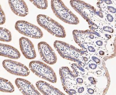Immunohistochemistry-Paraffin: Dfna5 Antibody [NBP2-80426]